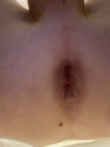 Spread ass Ass Butthole by Metatoxix