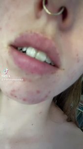 Tits Tiktok Onlyfans by TikTokPornApp