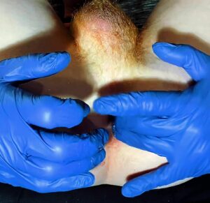 Ass fingering Ass Asshole by Metatoxix 1